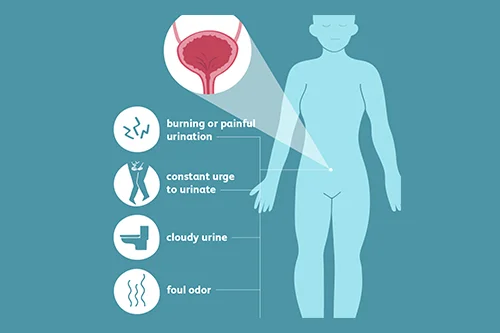 Urinary Tract Infection (UTI)